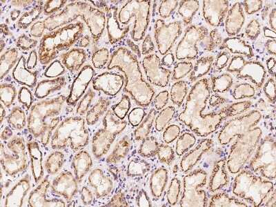 Immunohistochemistry-Paraffin: CYP1B1 Antibody [NBP2-97885]