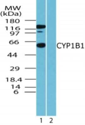 Western Blot: CYP1B1 Antibody [NBP2-50551]