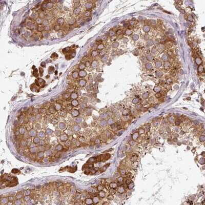 Immunohistochemistry-Paraffin: CYP20A1 Antibody [NBP2-31614]