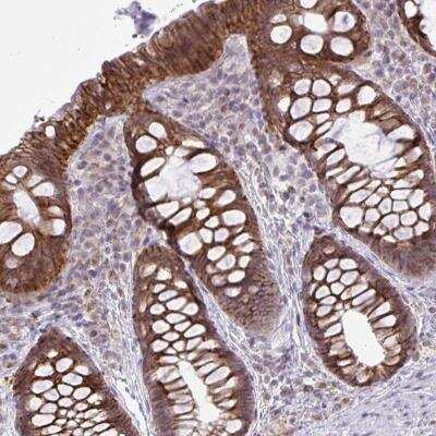 Immunohistochemistry-Paraffin: CYP20A1 Antibody [NBP2-31719]