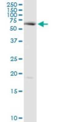 Western Blot: CYP20A1 Antibody [H00057404-D01P]