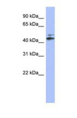 Western Blot: CYP20A1 Antibody [NBP1-69680]