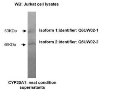 Western Blot: CYP20A1 Antibody (Z27-P3H7*E3)BSA Free [NBP2-50192]