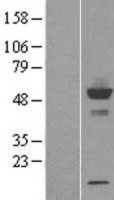 Western Blot: CYP20A1 Overexpression Lysate [NBL1-09677]