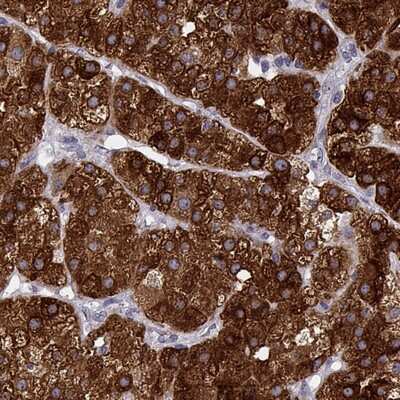 Immunohistochemistry-Paraffin: CYP21A2 Antibody [NBP2-13893]
