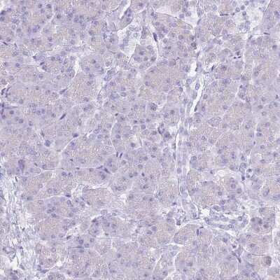 Immunohistochemistry-Paraffin: CYP21A2 Antibody [NBP2-13893]