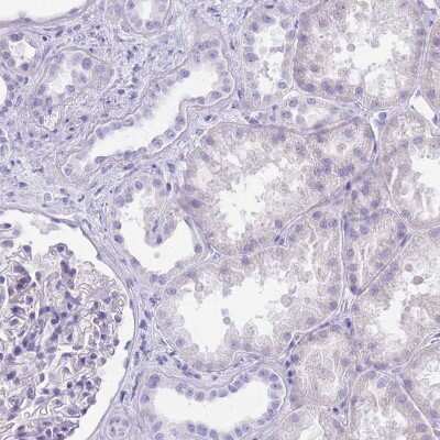 Immunohistochemistry-Paraffin: CYP21A2 Antibody [NBP2-13893]