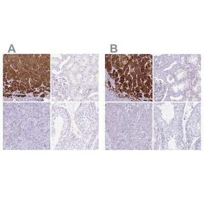 Immunohistochemistry-Paraffin: CYP21A2 Antibody [NBP2-38698]