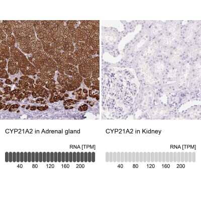 Immunohistochemistry-Paraffin: CYP21A2 Antibody [NBP2-38698]