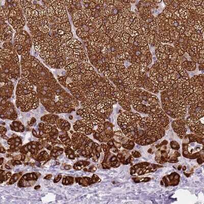 Immunohistochemistry-Paraffin: CYP21A2 Antibody [NBP2-38698]