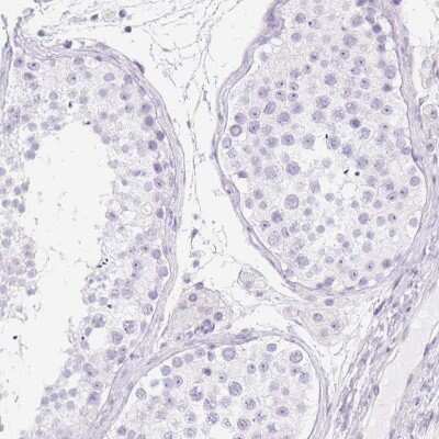 Immunohistochemistry-Paraffin: CYP21A2 Antibody [NBP2-38698]