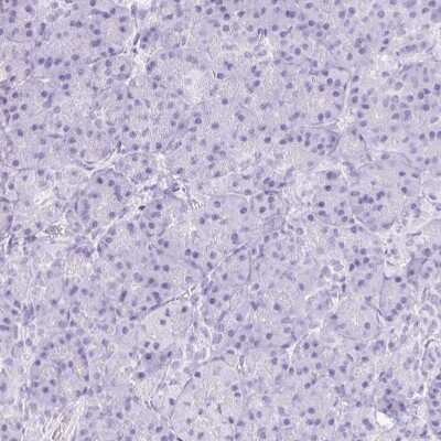 Immunohistochemistry-Paraffin: CYP21A2 Antibody [NBP2-38698]
