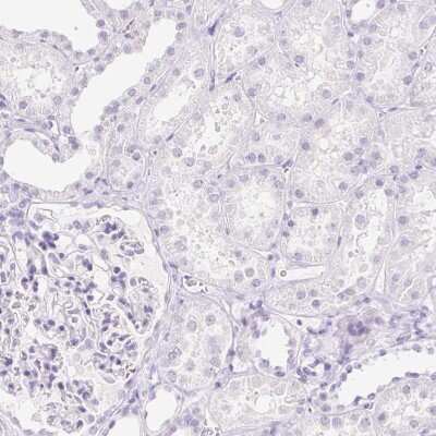 Immunohistochemistry-Paraffin: CYP21A2 Antibody [NBP2-38698]