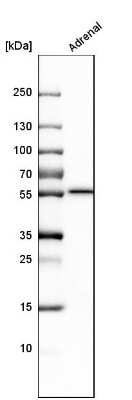 Western Blot: CYP21A2 Antibody [NBP2-13893]