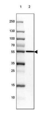 Western Blot: CYP21A2 Antibody [NBP2-38698]
