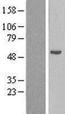 Western Blot: CYP21A2 Overexpression Lysate [NBP2-09016]