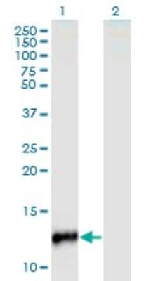 Western Blot: CYP24A1 Antibody (1E1) [H00001591-M02]