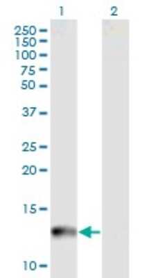 Western Blot: CYP24A1 Antibody (1F8) [H00001591-M07]