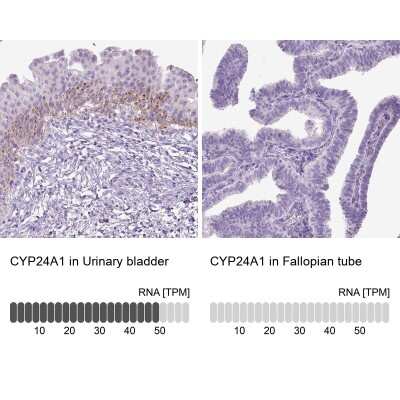 Immunohistochemistry-Paraffin: CYP24A1 Antibody [NBP1-85495]