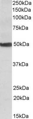 Western Blot: CYP24A1 Antibody [NBP1-52111]