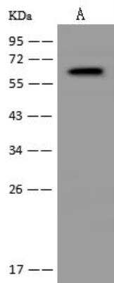 Western Blot: CYP24A1 Antibody [NBP3-05981]