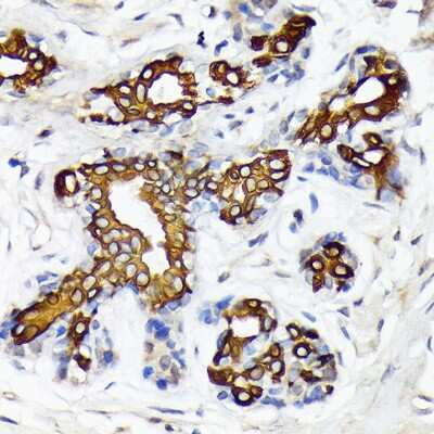 Immunohistochemistry-Paraffin: CYP26A1 Antibody (1E1D2) [NBP3-16627]