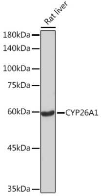 Western Blot: CYP26A1 Antibody (1E1D2) [NBP3-16627]