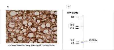 Immunohistochemistry: CYP26A1 Antibody (F27 P6 A1) [NBP3-11915]