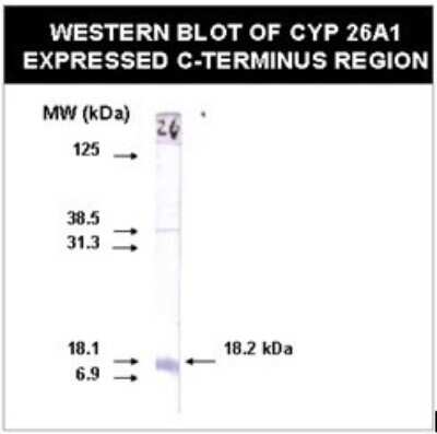 Western Blot: CYP26A1 Antibody (F27P6A1)BSA Free [NBP2-50193]