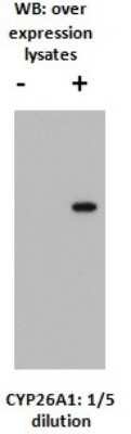 Western Blot: CYP26A1 Antibody (F27P6A1)BSA Free [NBP2-50193]