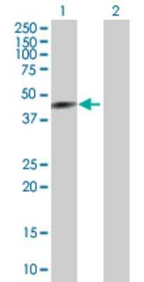 Western Blot: CYP26A1 Antibody [H00001592-B01P]