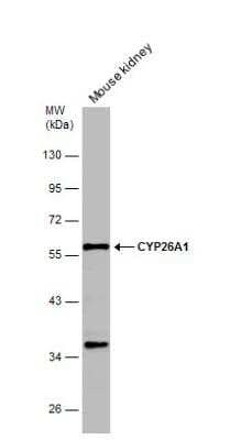 Western Blot: CYP26A1 Antibody [NBP2-16061]