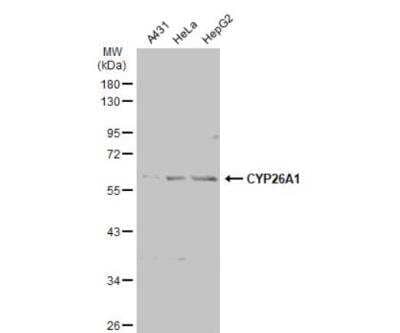 Western Blot: CYP26A1 Antibody [NBP2-16061]