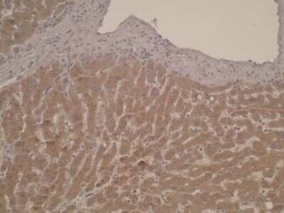 Immunohistochemistry: CYP26C1 Antibody (T6P1C7*E7) - BSA Free [NBP2-50196]
