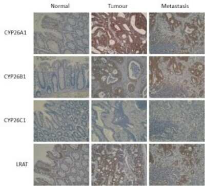 Immunohistochemistry: CYP26C1 Antibody (T6P1C7*E7) - BSA Free [NBP2-50196]