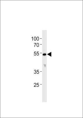 Western Blot: CYP26C1 AntibodyBSA Free [NBP3-06730]