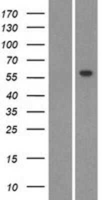 Western Blot: CYP26C1 Overexpression Lysate [NBP2-04787]