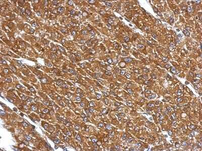 Immunohistochemistry-Paraffin: CYP27A1 Antibody [NBP2-16062]