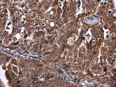 Immunohistochemistry-Paraffin: CYP27A1 Antibody [NBP2-16062]