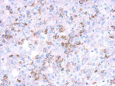 Immunohistochemistry-Paraffin: CYP27A1 Antibody [NBP2-16063]