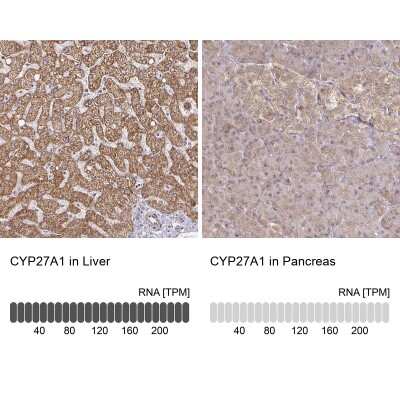 Immunohistochemistry-Paraffin: CYP27A1 Antibody [NBP2-32433]