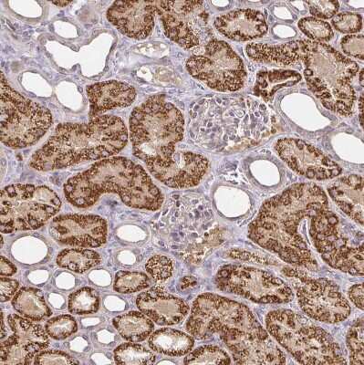 Immunohistochemistry-Paraffin: CYP27A1 Antibody [NBP2-32433]