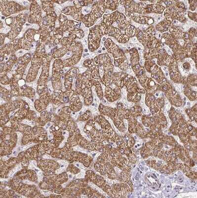 Immunohistochemistry-Paraffin: CYP27A1 Antibody [NBP2-32433]
