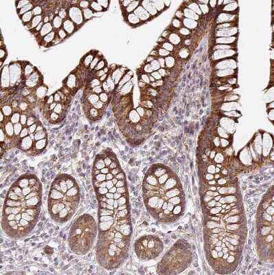 Immunohistochemistry-Paraffin: CYP27A1 Antibody [NBP2-32433]