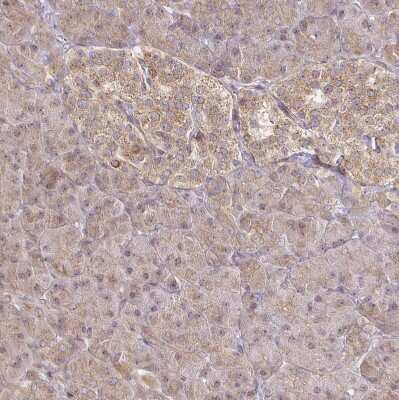 Immunohistochemistry-Paraffin: CYP27A1 Antibody [NBP2-32433]