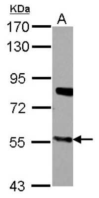 Western Blot: CYP27A1 Antibody [NBP2-16062]