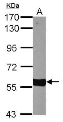 Western Blot: CYP27A1 Antibody [NBP2-16062]