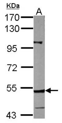 Western Blot: CYP27A1 Antibody [NBP2-16063]