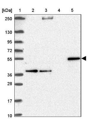 Western Blot: CYP27A1 Antibody [NBP2-32433]