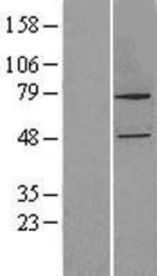 Western Blot: CYP27B1 Overexpression Lysate [NBL1-09682]